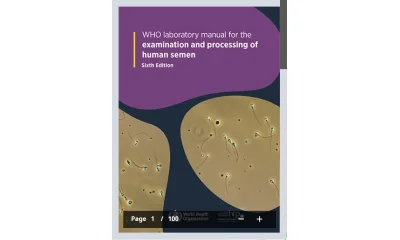 WHO 6th Edition Semen Analysis Standards guide with CASA system, Nexus Dx1, Sperm Motility, Sperm Morphology, and Built-in heating stage