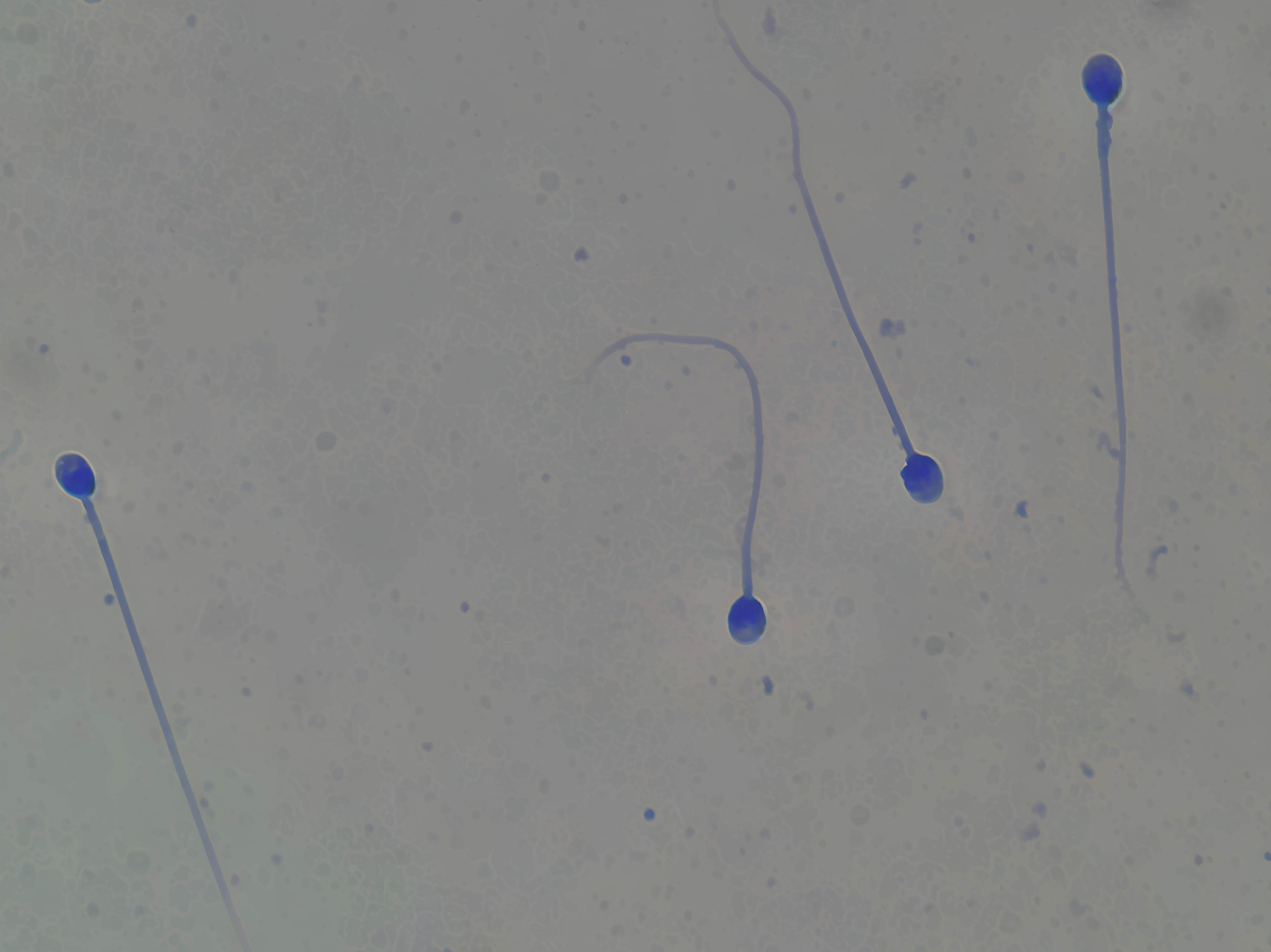 MorphoBlue Image 2
