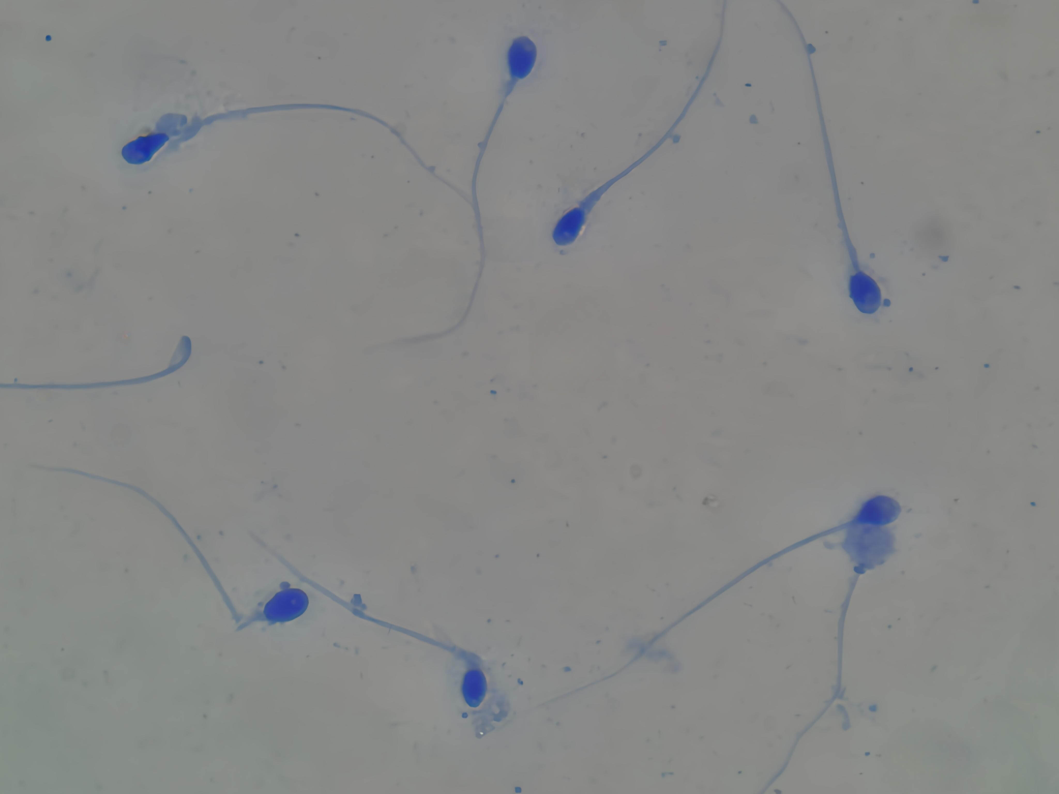 MorphoBlue Image 3